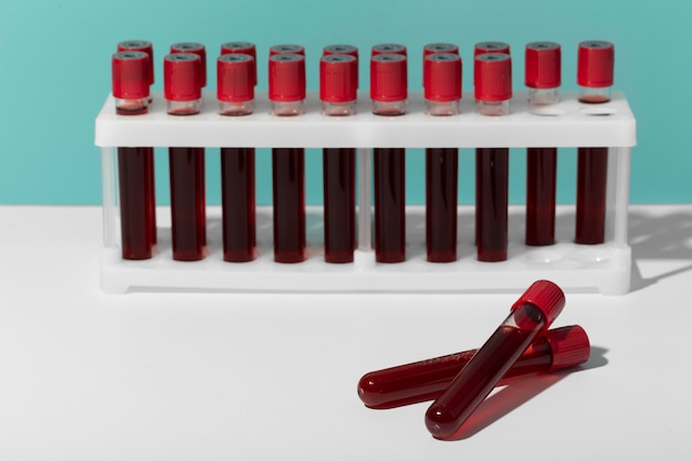 Blood Coagulation Analyzers Market