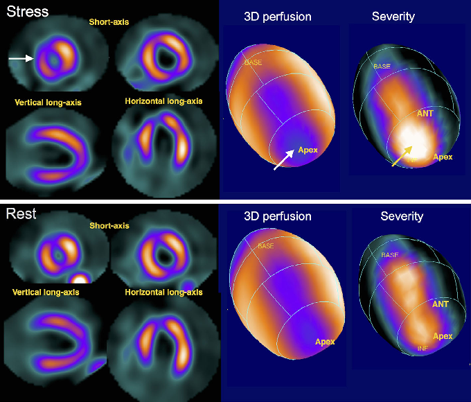 Perfusion Imaging Market