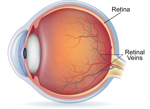 Retinal Vein Occlusion Treatment Market