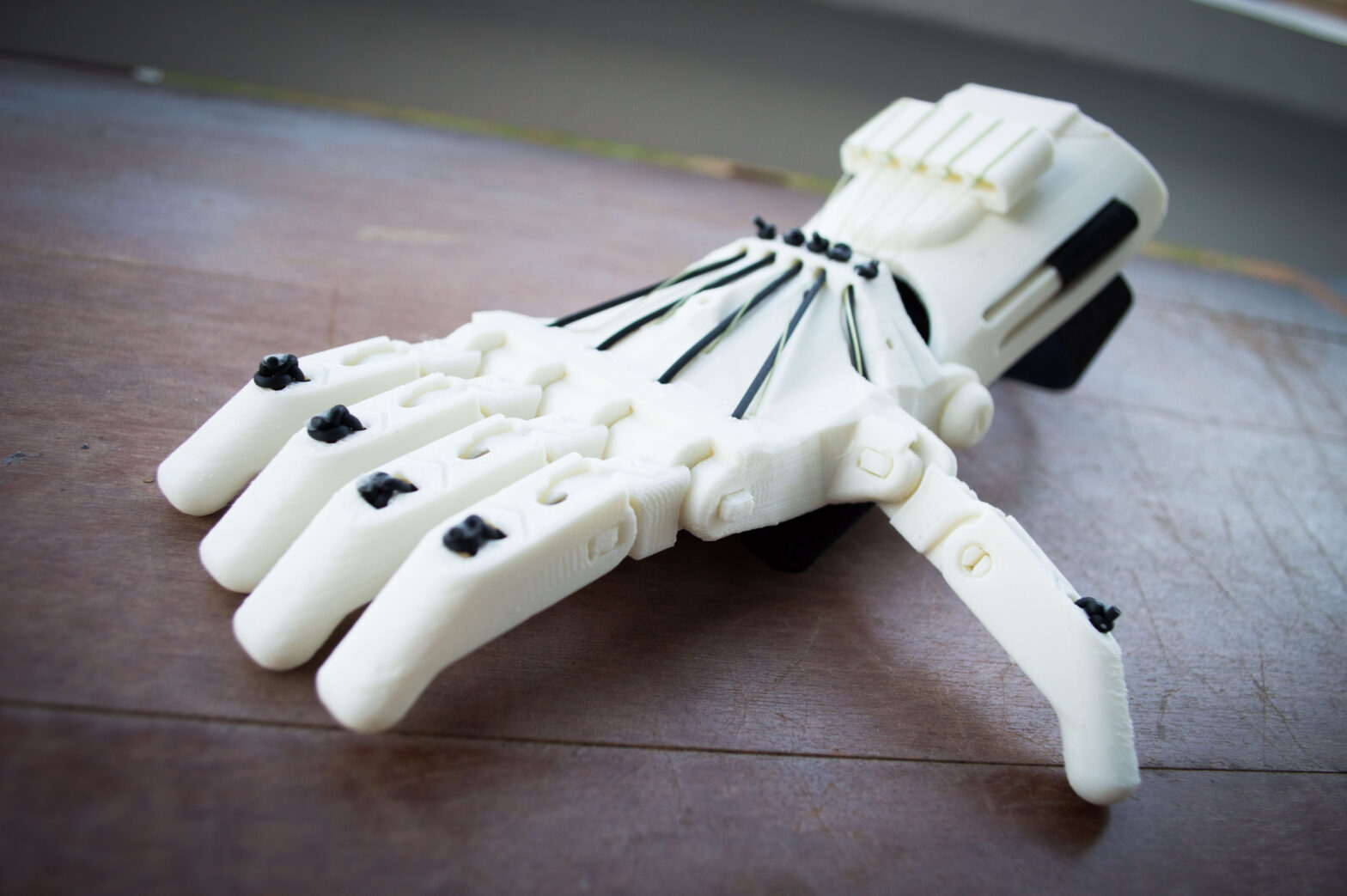 3D Printed Prosthetics Market