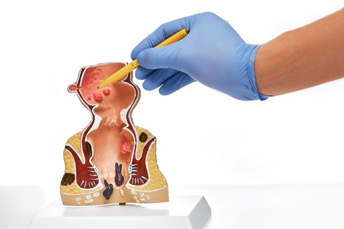 Anorectal Manometry Systems Market