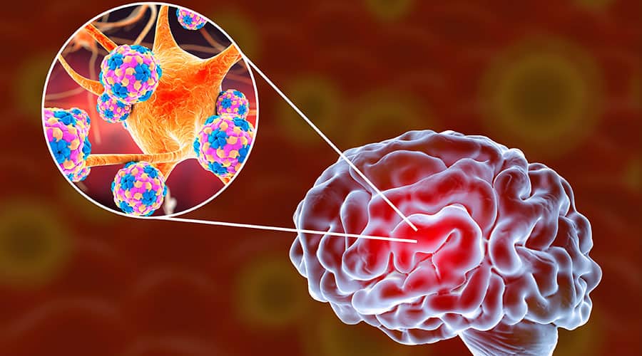 Encephalitis Treatment Market