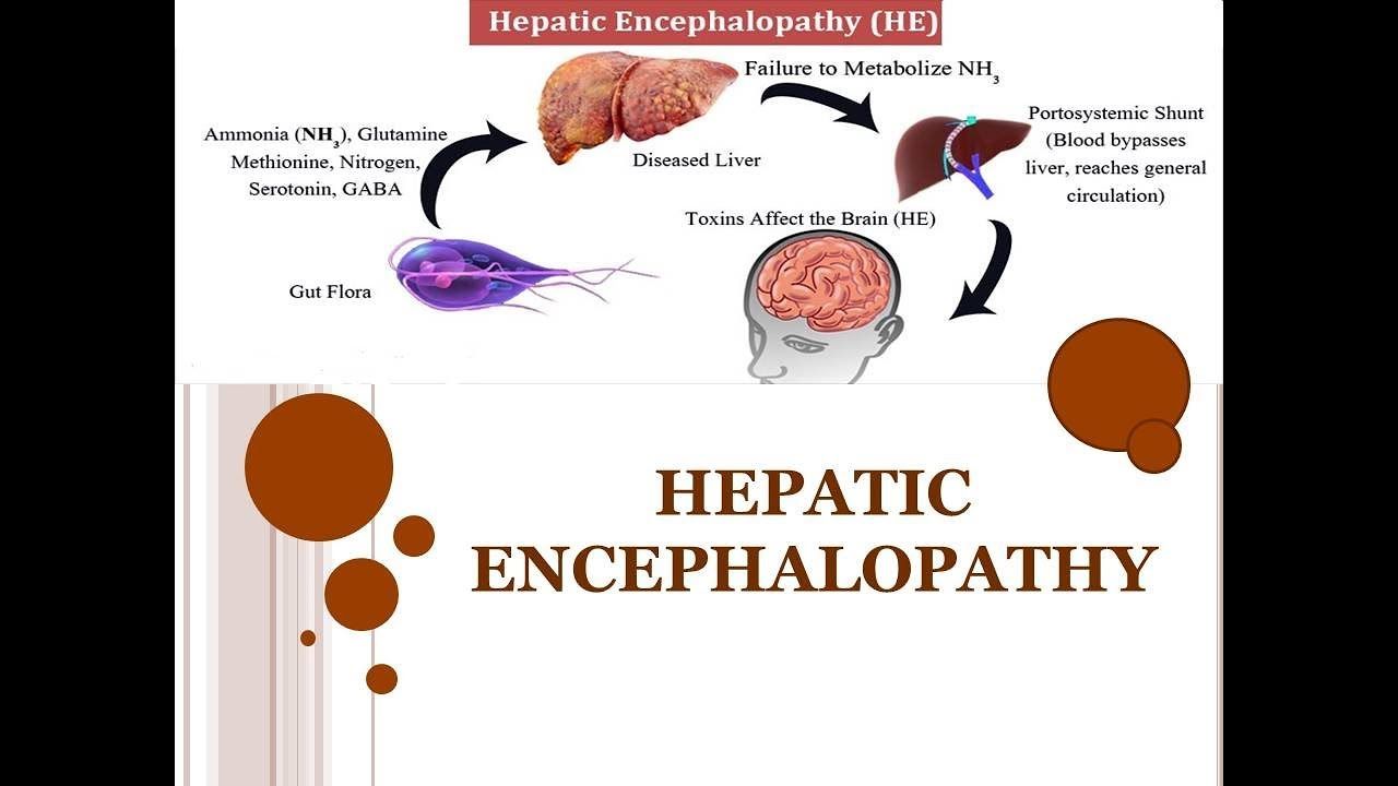 Hepatic Encephalopathy Treatment Market