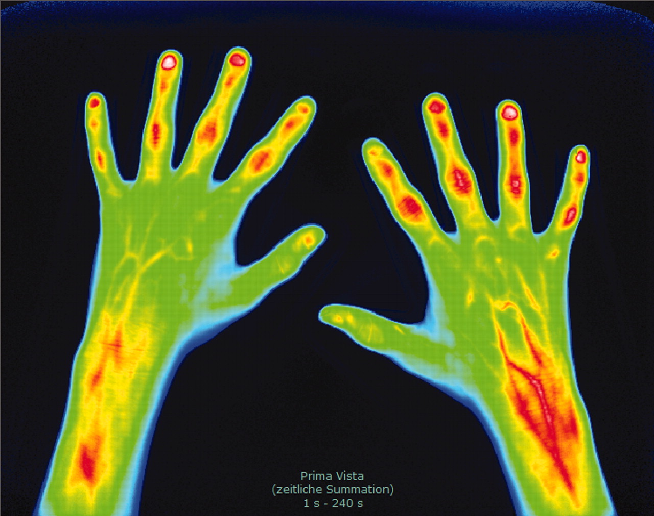 Optical Imaging Market