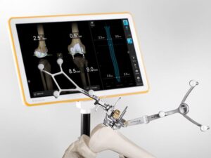 orthopedic navigation systems industry