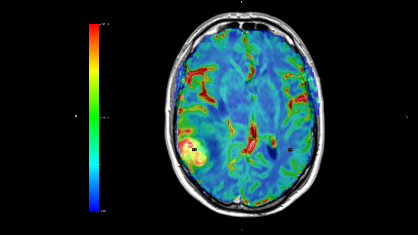 Perfusion Imaging Market