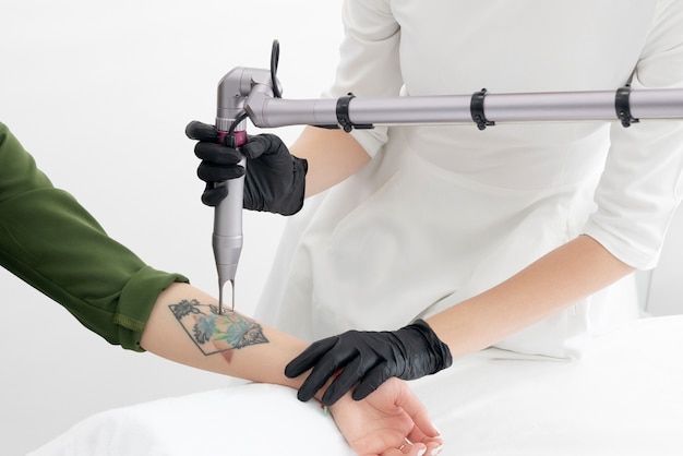 Tattoo Removal Lasers Market