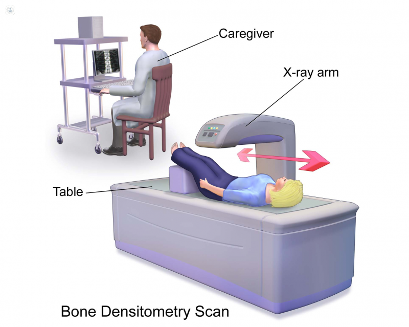 Bone Densitometer Devices Market