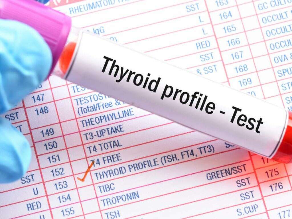 Thyroid Function Tests Market