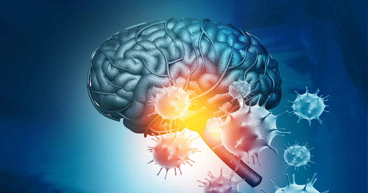 Chronic Brain Damage Management Market