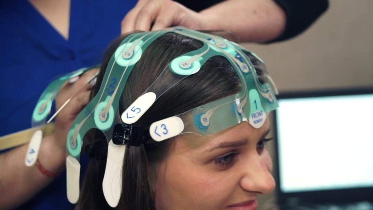 Disposable EEG Electrode Market