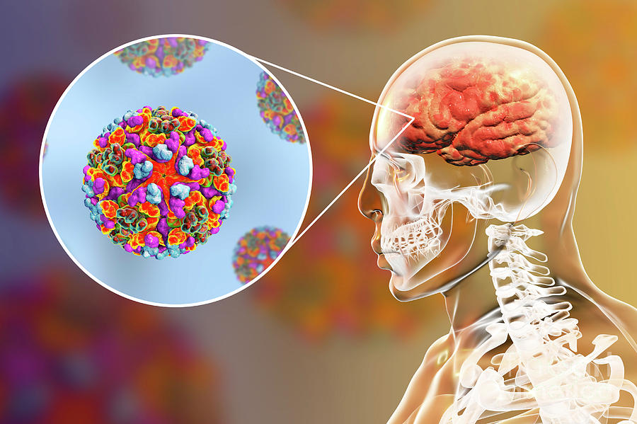 Encephalitis Management Market