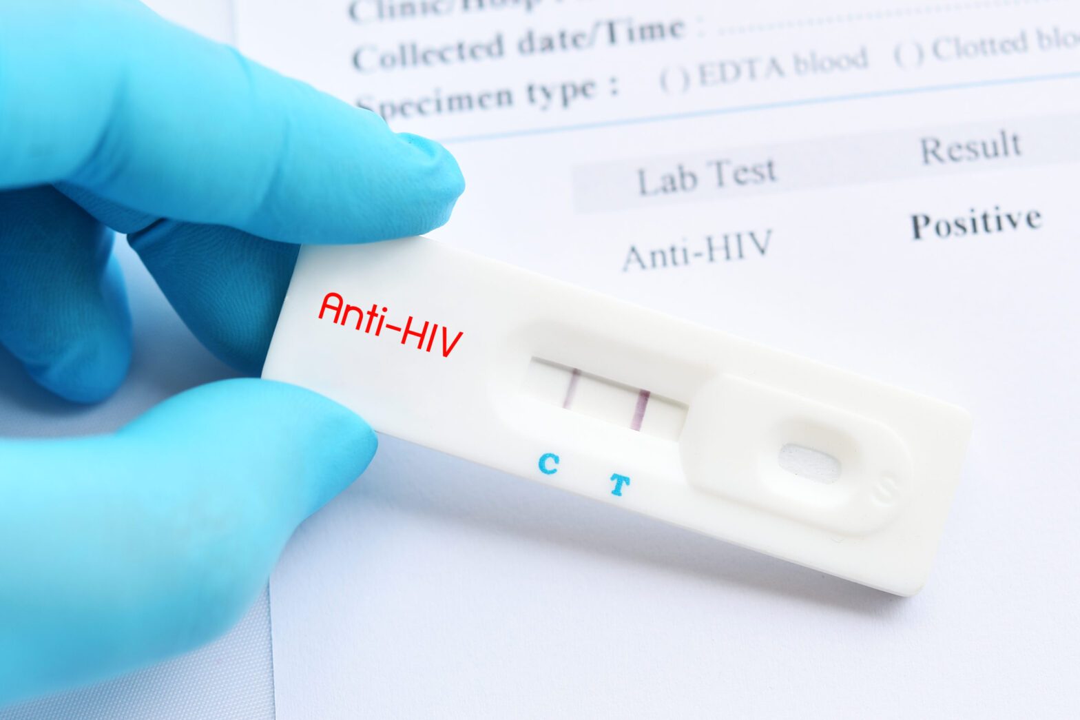 Human Immunodeficiency Virus Type 1 (HIV 1) Market