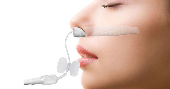 Nasal Packing Devices Market