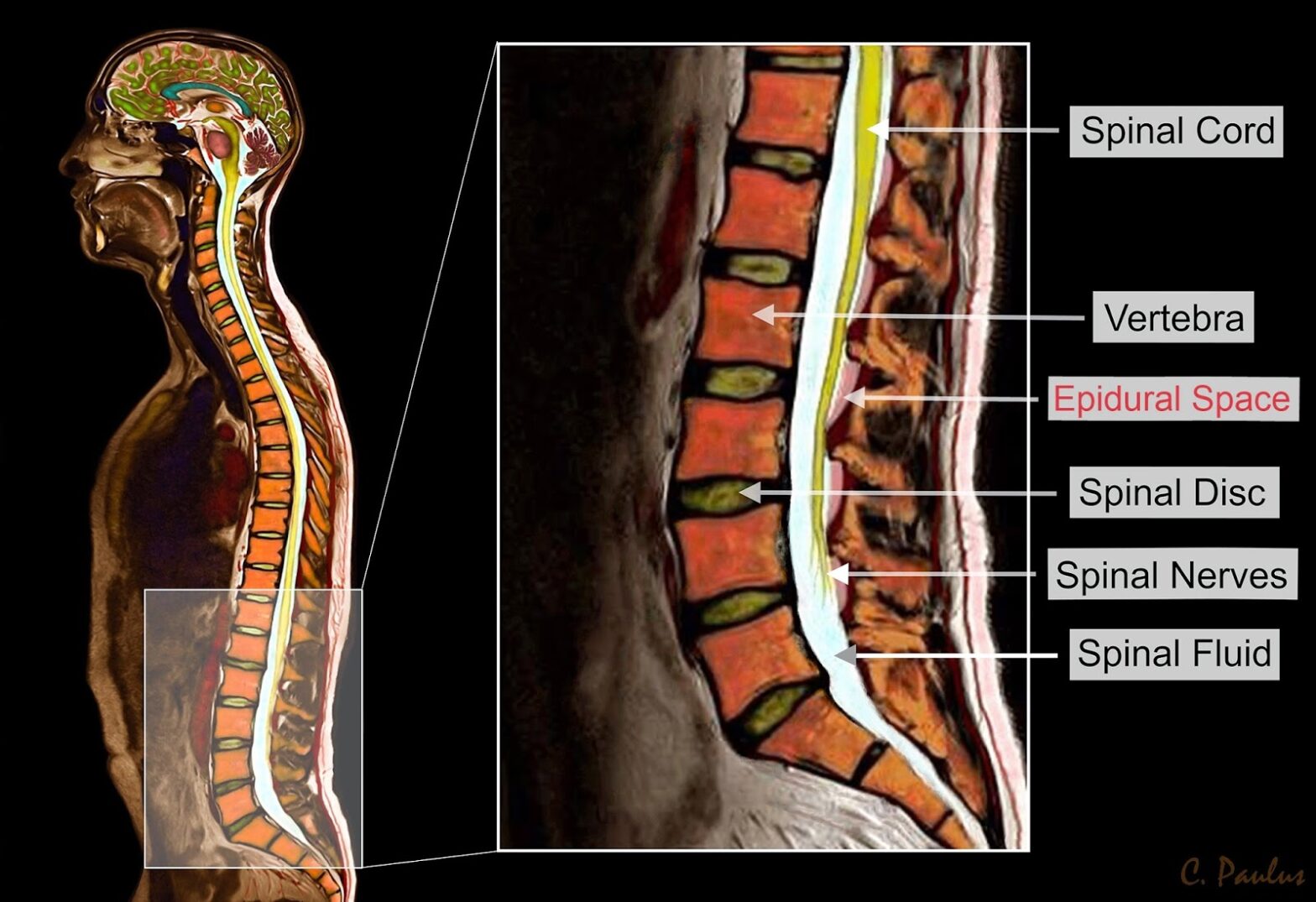 Spinal Imaging Market