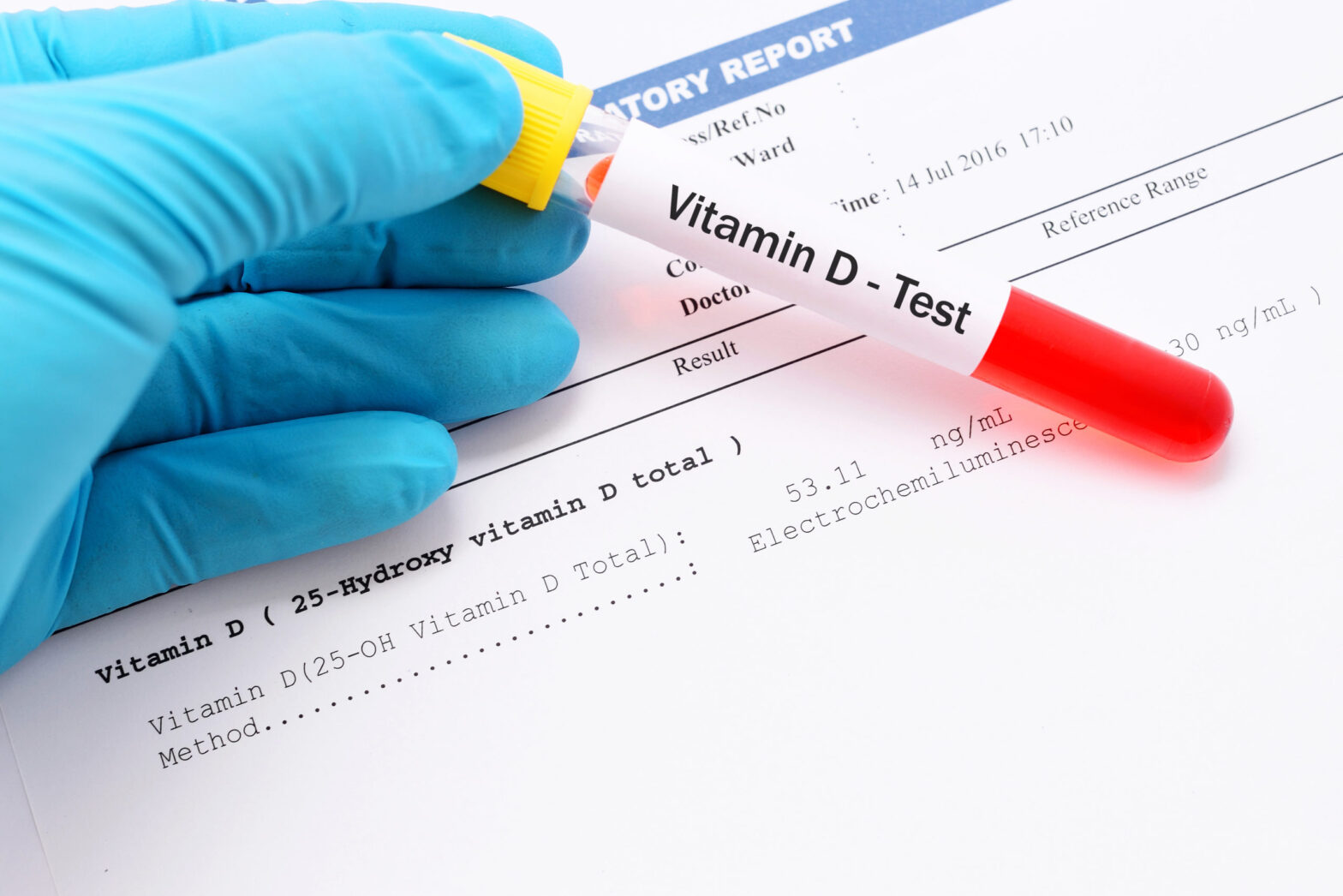 Vitamin D Testing Market