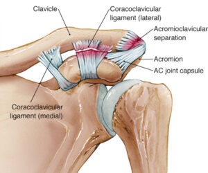 ligament augmentation market