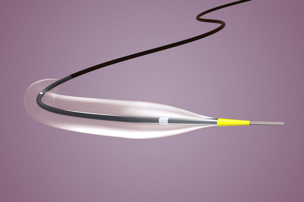 Balloon Catheter Market