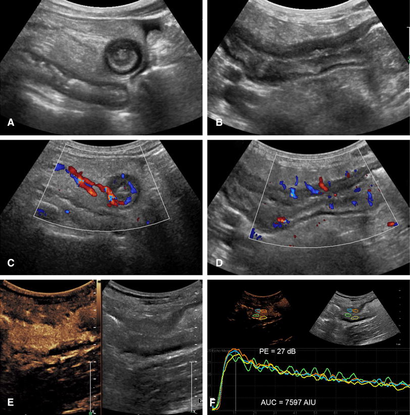 Contrast-Enhanced Ultrasound Industry