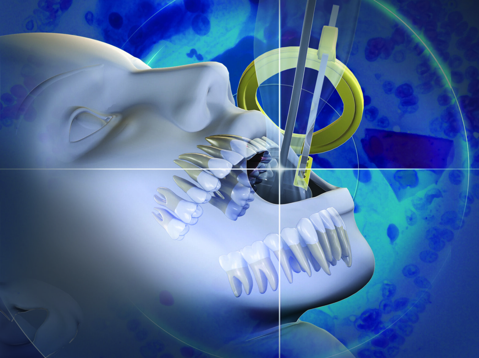 Dental X-ray Systems Industry