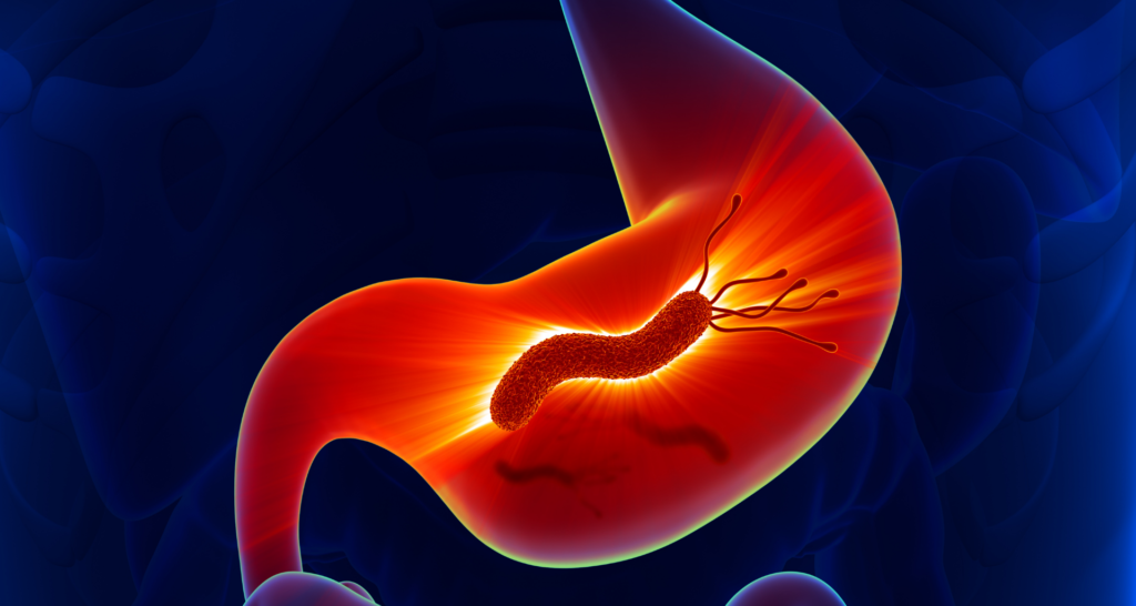 Helicobacter Pylori Infections Treatment Industry