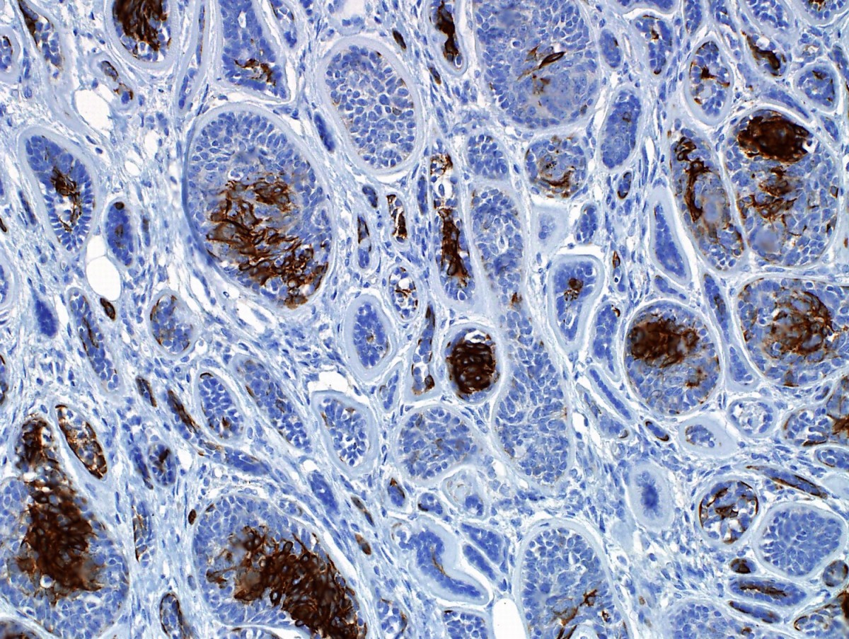 Immunohistochemistry Market