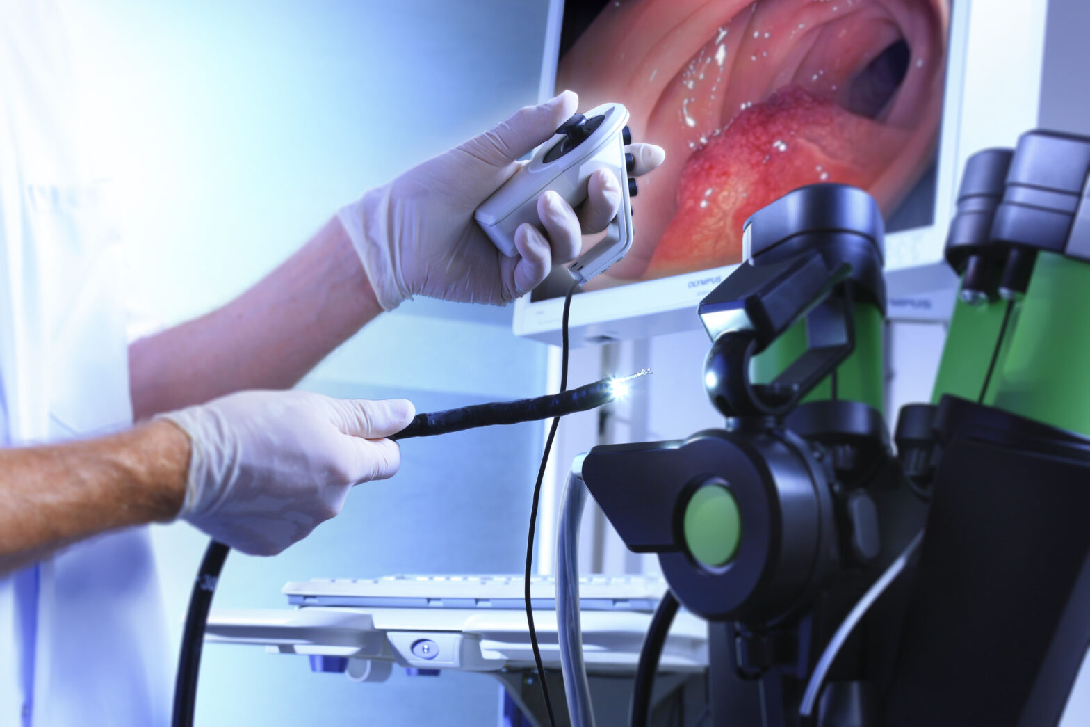 Mobile Endoscopic Workstations Industry