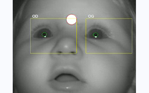 New Born Eye Imaging Systems Industry