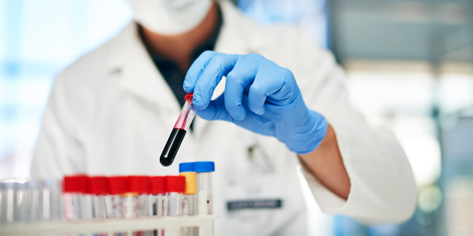 Oncology Blood Testing Market