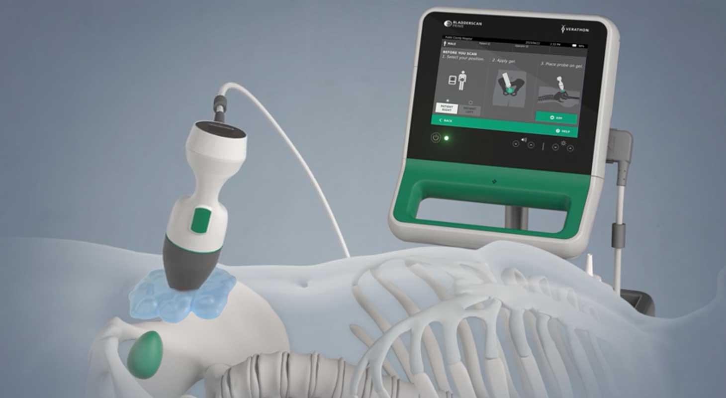 Portable Ultrasound Bladder Scanner Market