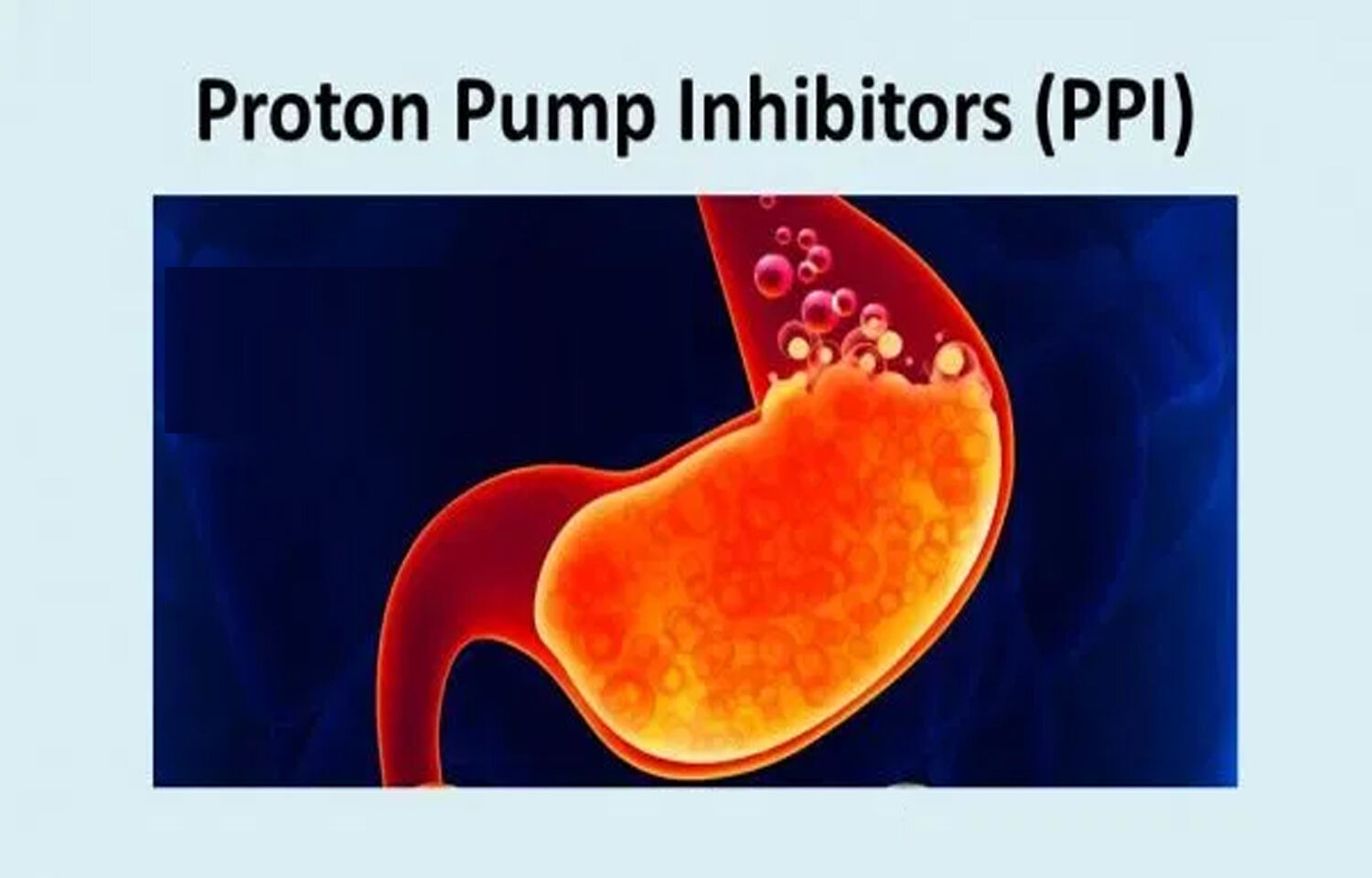Proton Pump Inhibitors Industry