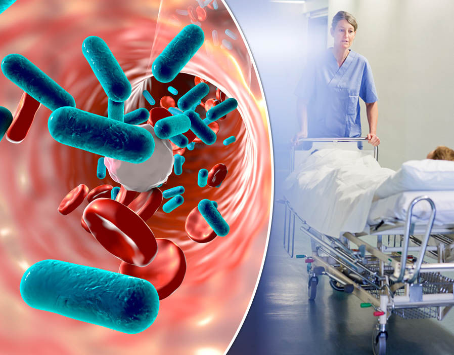 Sepsis Diagnostics Market