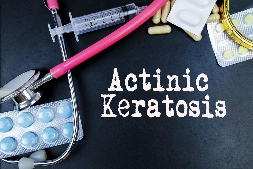 Actinic Keratosis Treatment Industry