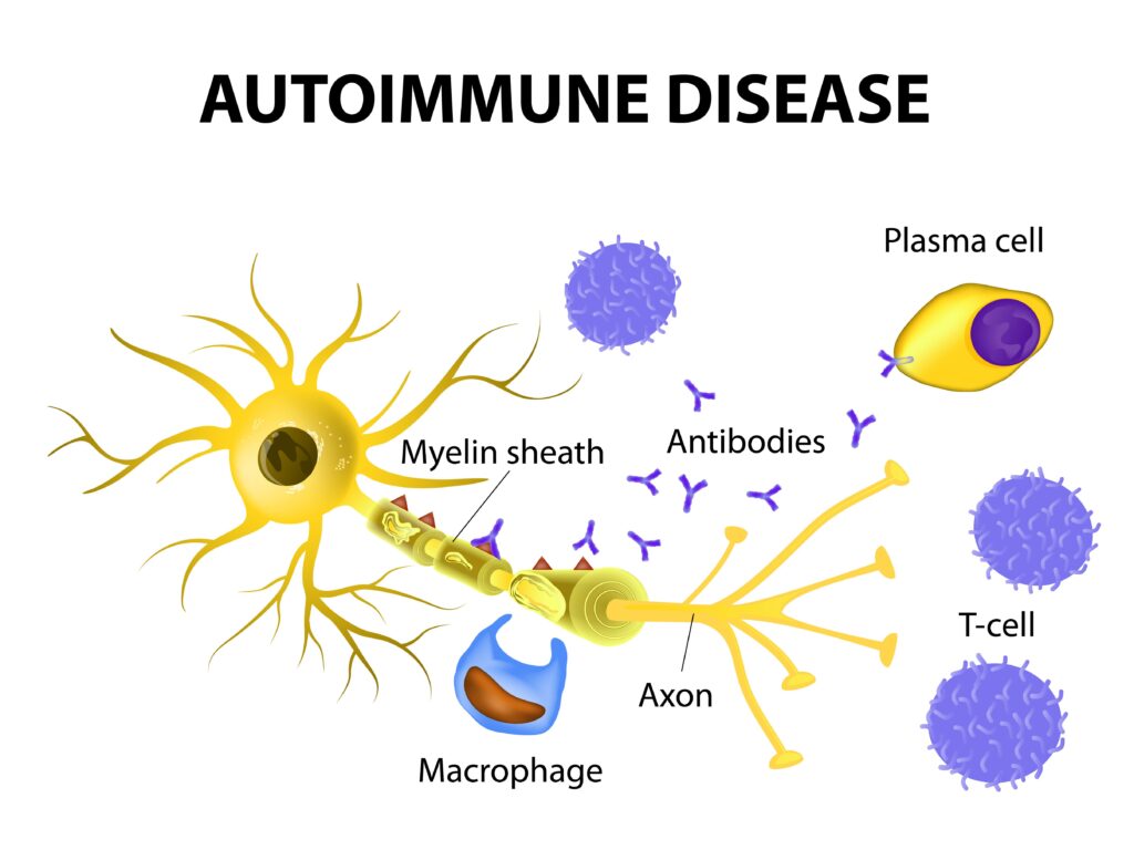 Autoimmune Disease Therapeutics Market