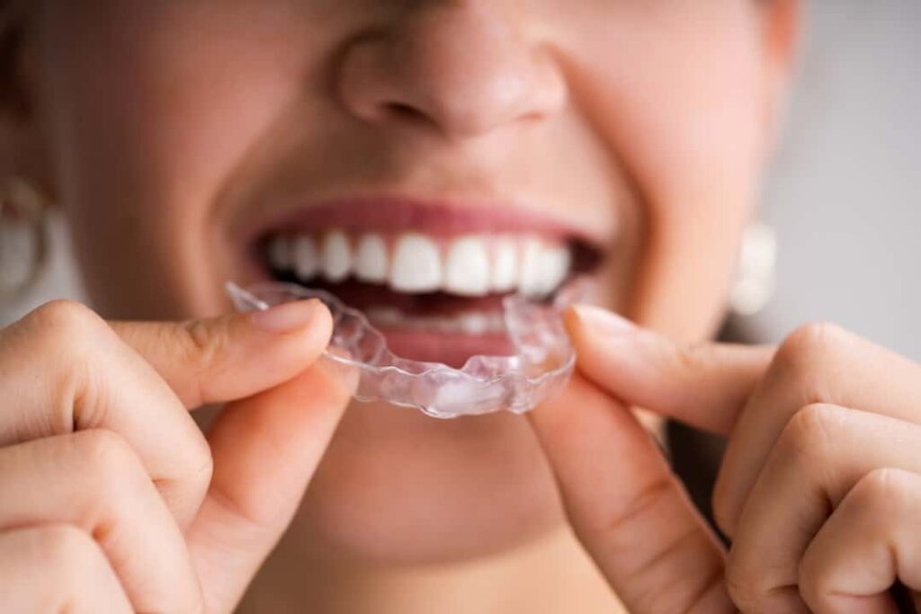 Bruxism Management Industry