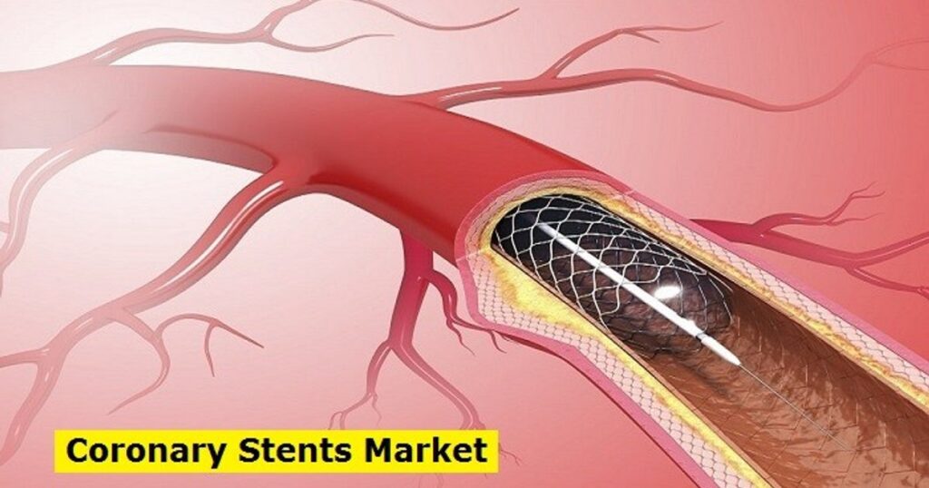 Coronary Stents Market