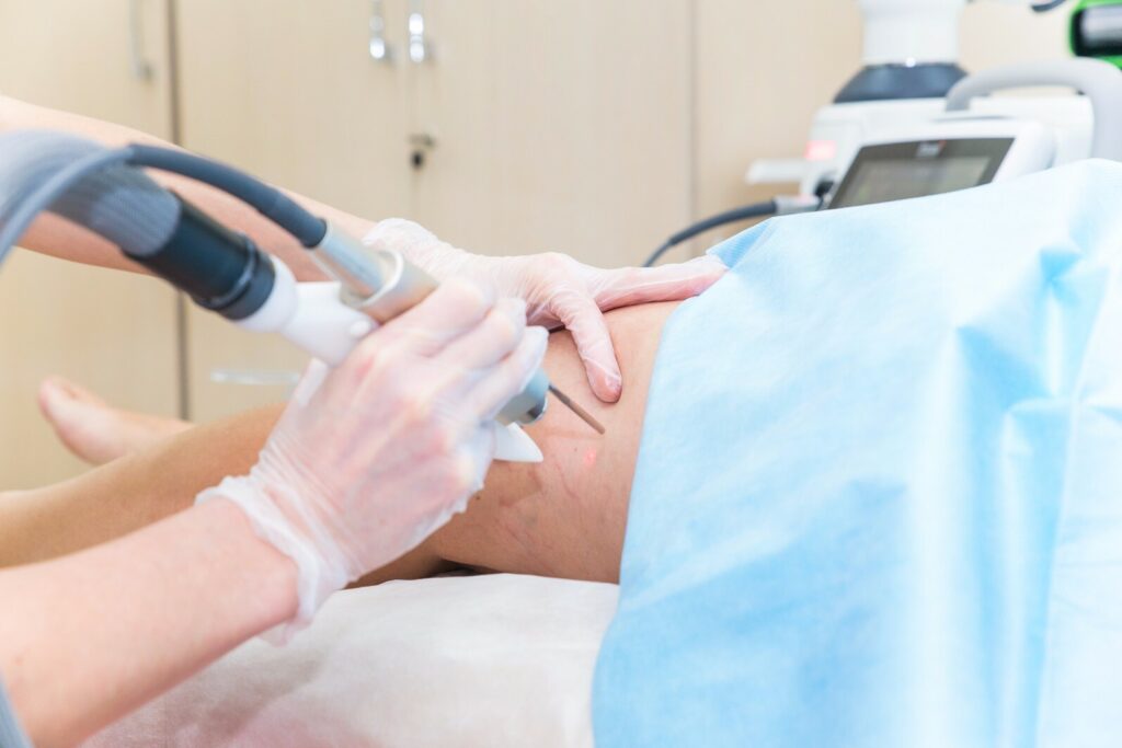 Endovenous Laser Therapy Market