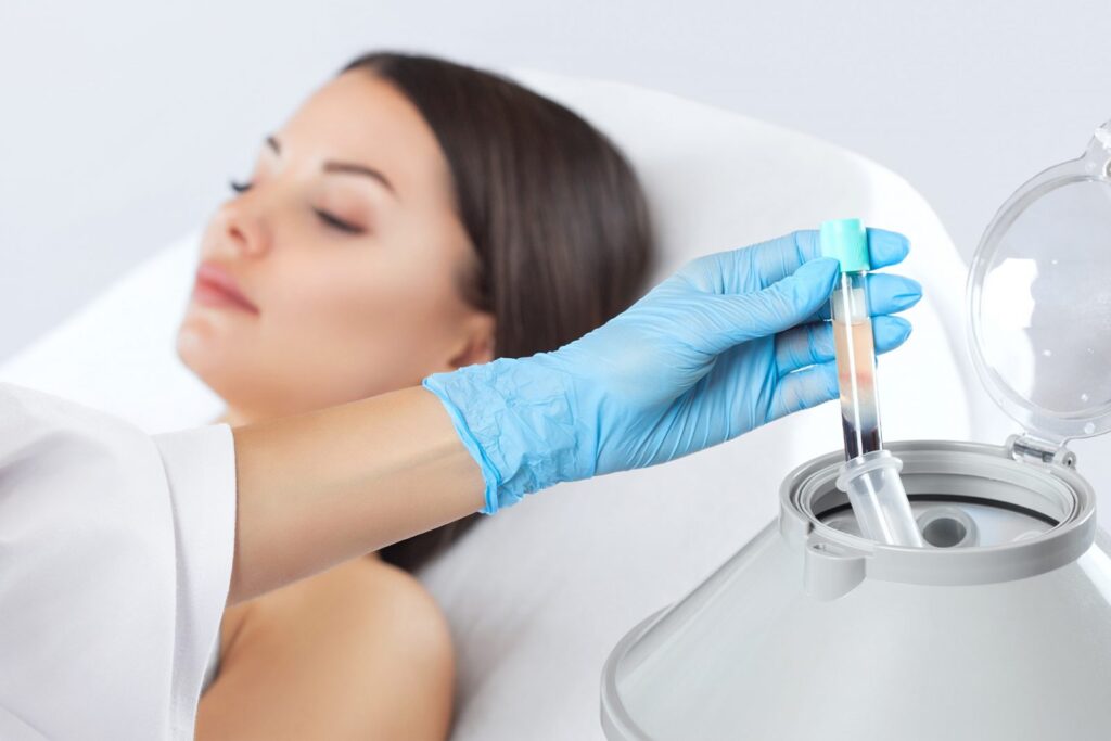 Europe platelet rich plasma (PRP) Market