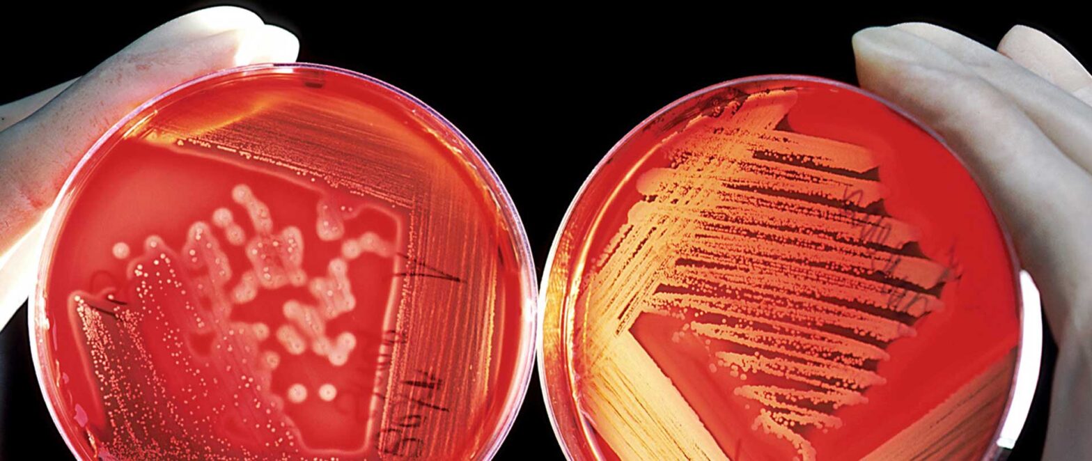 Global Bacterial Diagnostics in Aquaculture Industry