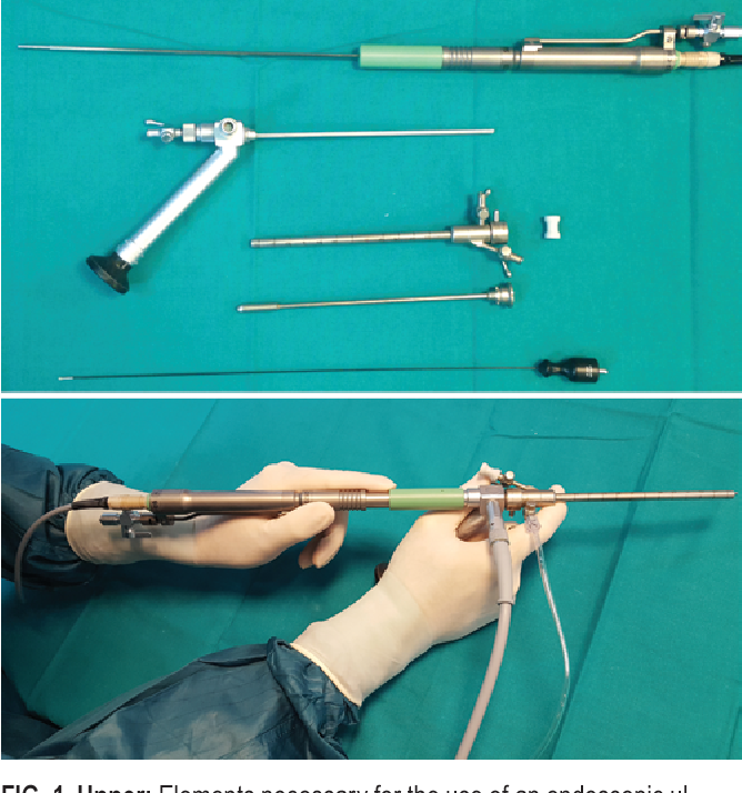 Global Endoscopic Vessel Harvesting System Industry