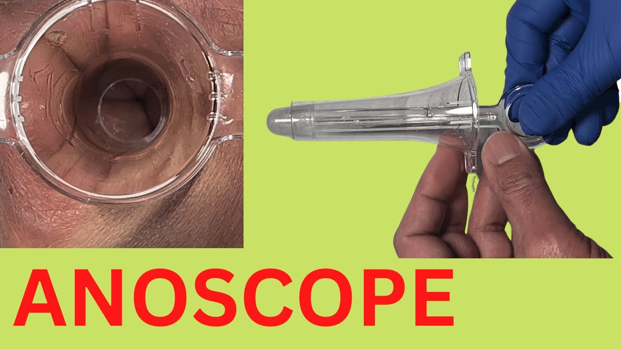 Global High-Resolution Anoscopy Industry