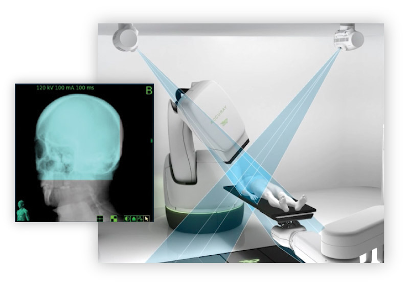 Global Radiation Therapy Software Industry