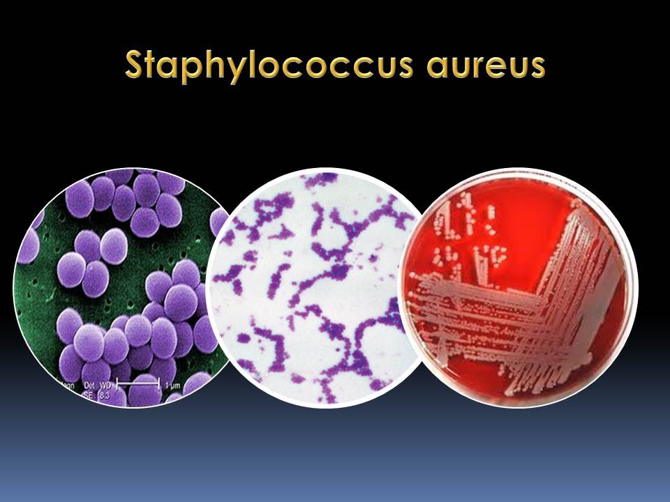 Global Staphylococcus Aureus Testing Industry