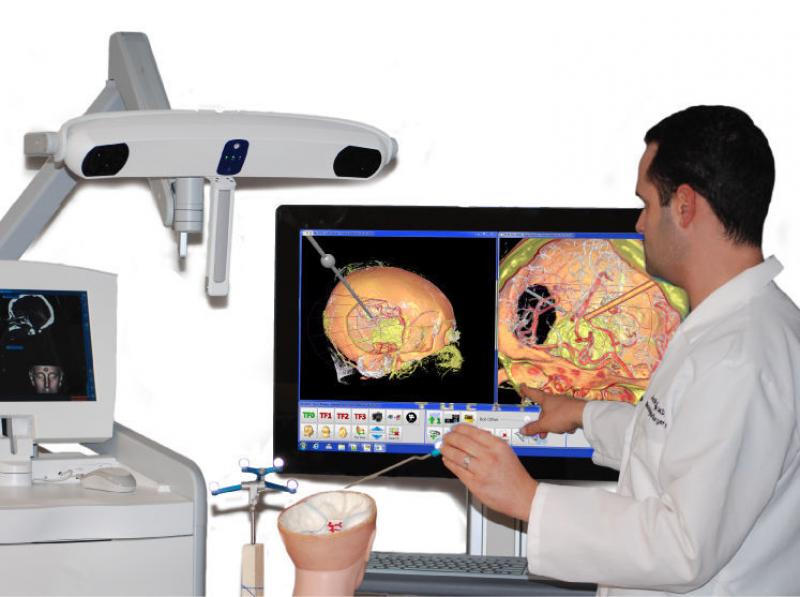 Surgical Navigation System Market