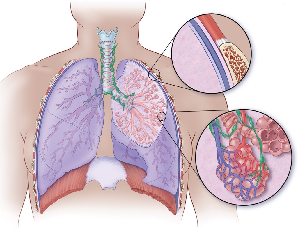 Non-Small Cell Lung Cancer Market