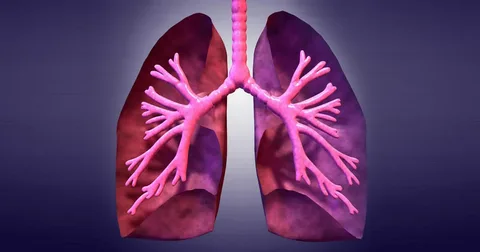 Global Pulmonary Fibrosis Biomarker Market