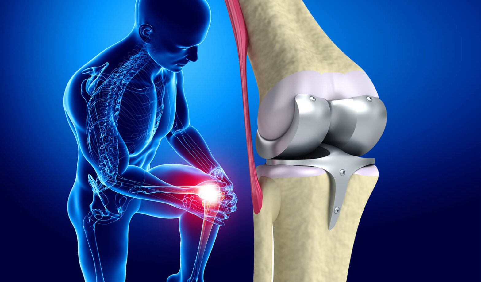 Revision Knee Replacement Market