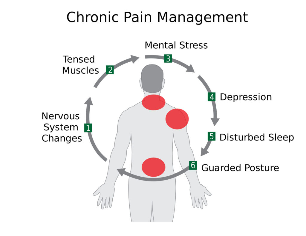 Chronic Pain Industry