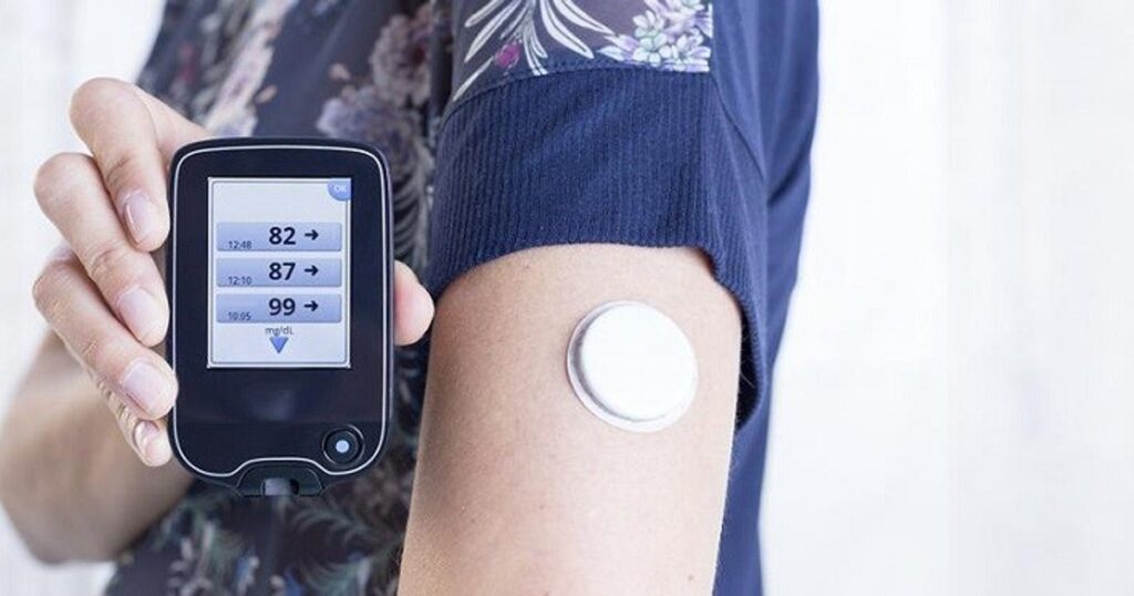 Continuous Glucose Monitoring Devices Industry