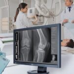 Diagnostic X-Ray System market